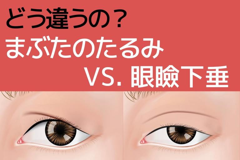 まぶたのたるみと眼瞼下垂はどう違う? 治療に保険はきく? きかない?